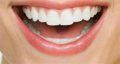 The Magic of Pearly Whites: A Smile Transformation in San Juan TX